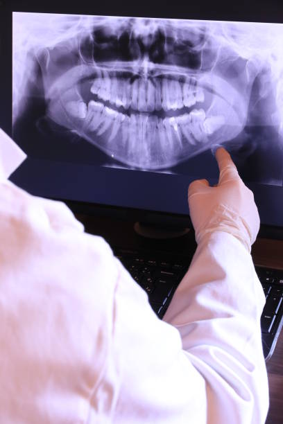 Best Emergency Dentist for Lost Fillings or Crowns in Lanark, IL